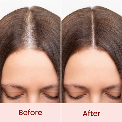 Jaquline USA Hair ZAP Hair Growth Serum 30ml